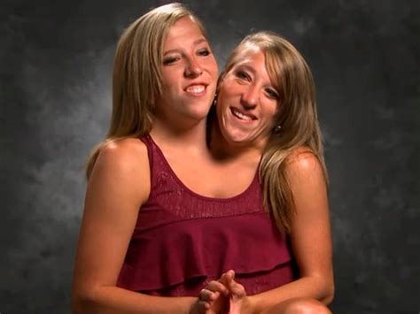 2 headed sisters dating